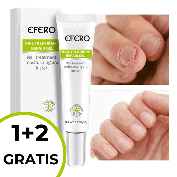 Efero® Nagelherstelgel: Tijdelijk 1+2 GRATIS Aanbieding!