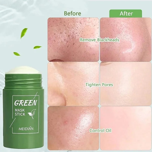 Green™ Masker | Diep reinigend masker (1+1 GRATIS)