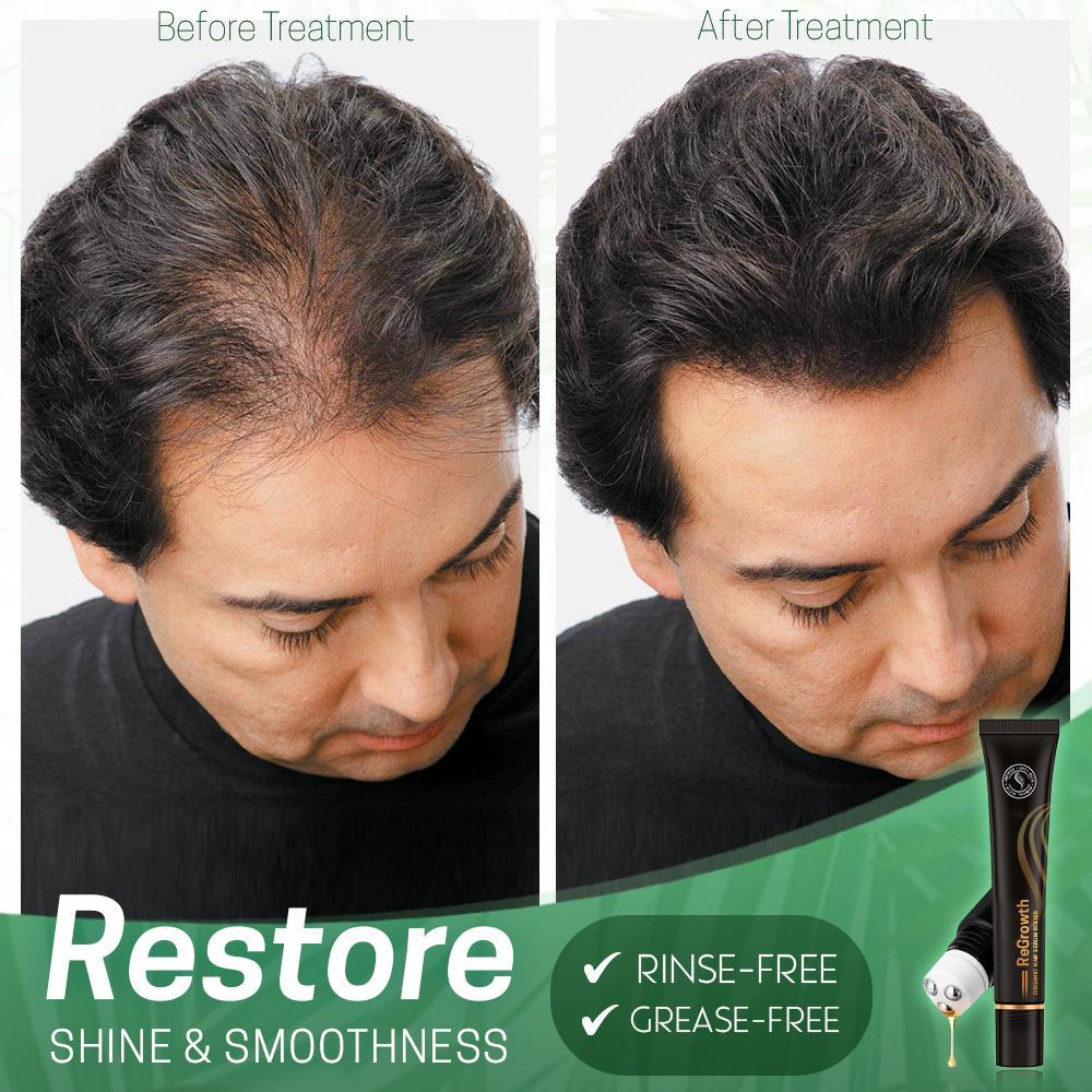 Regrowth™ - Bio Hair Serum Roller (1+1 GRATIS)