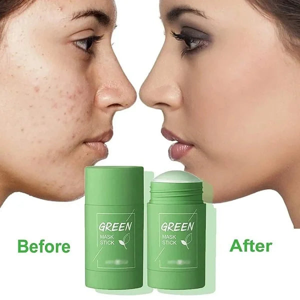 Green™ Masker | Diep reinigend masker (1+1 GRATIS)