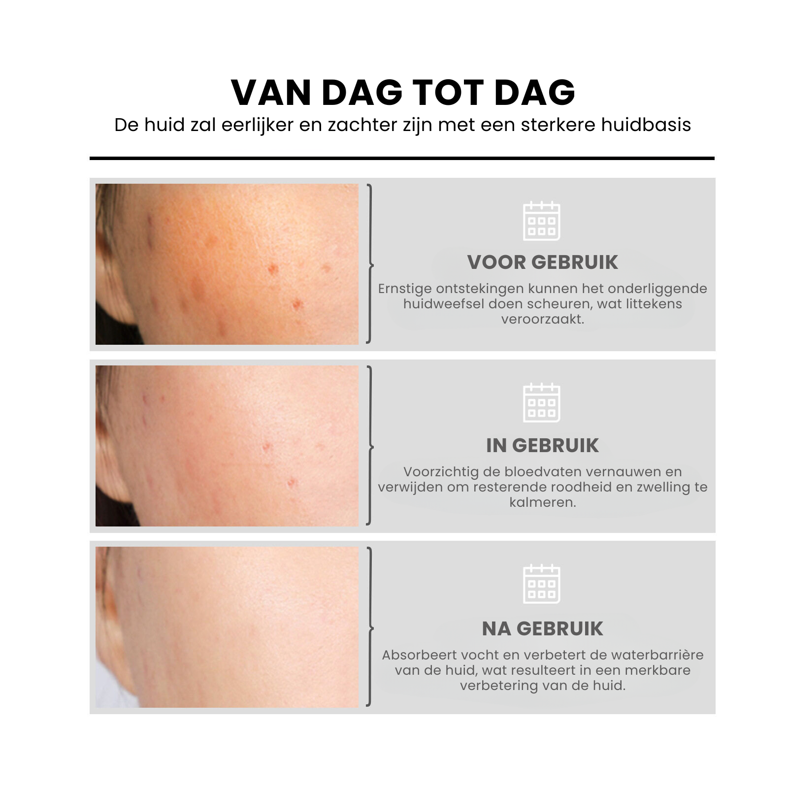 NiaRadiant™ | Huid Egalisatie Serum