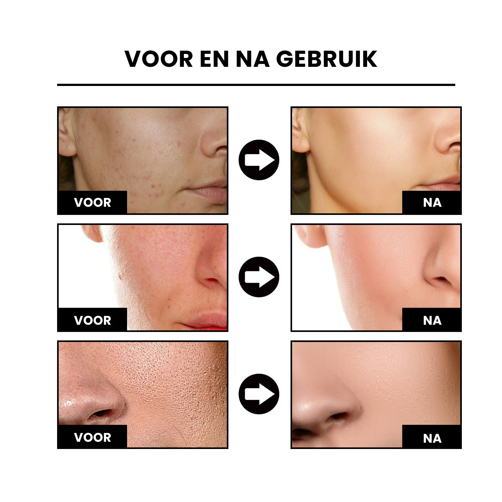 NiaRadiant™ | Huid Egalisatie Serum