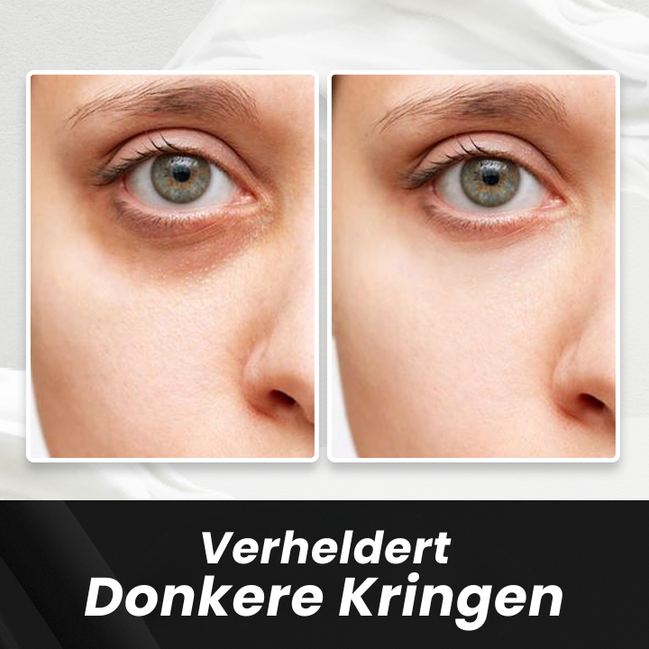 TightEase™ | Direct Verstrakkende Oogcrème